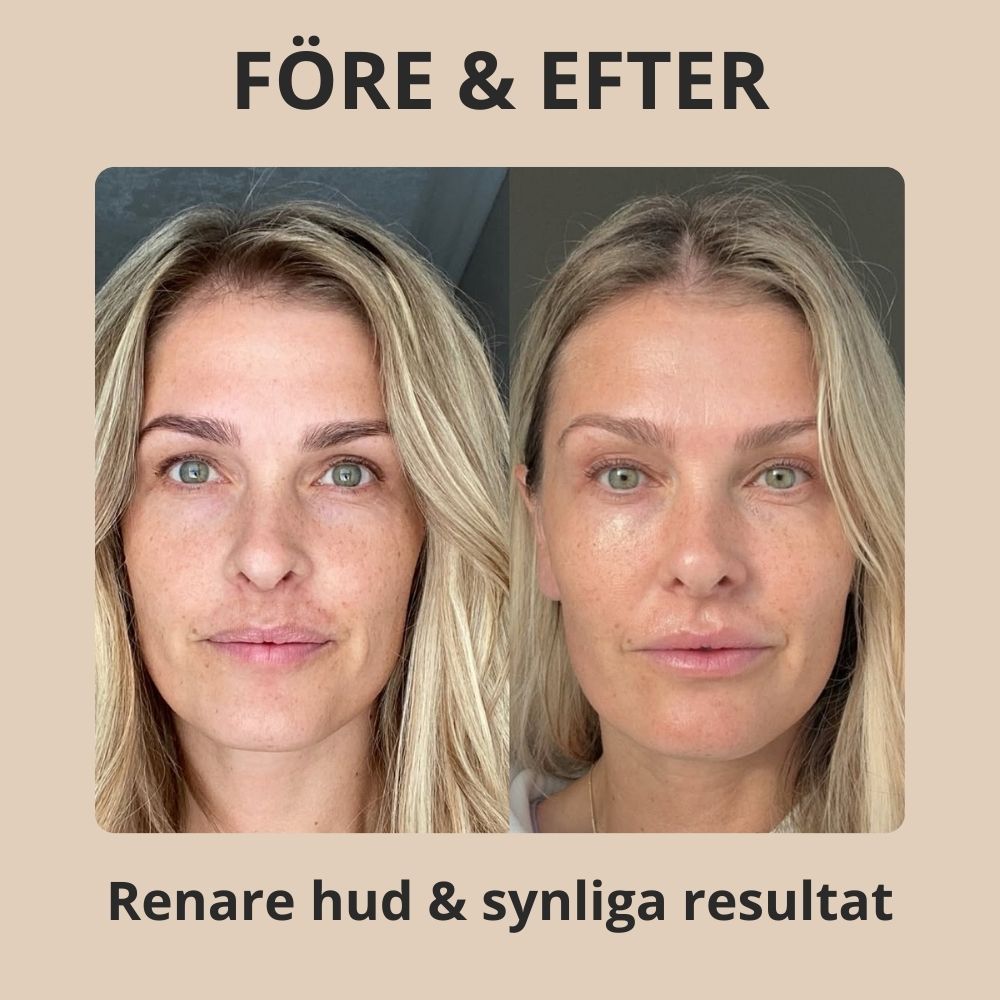 Tizwe - Rice Peel Shot Serum