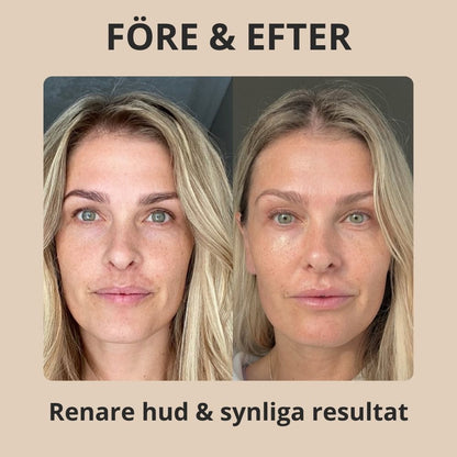 Tizwe - Rice Peel Shot Serum